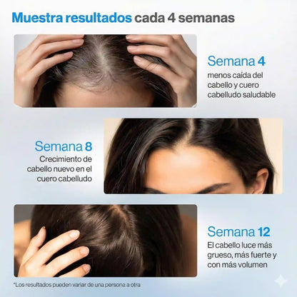 Roll-On Revitalizante Bodywise con Romero y Redensyl: Recuperá la densidad de tu cabello sin enchastres.