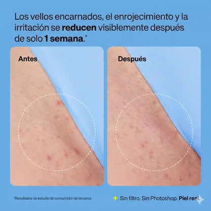 Peach Slices Smoothing Solution: Tu secreto para una piel libre de vellos encarnados.
